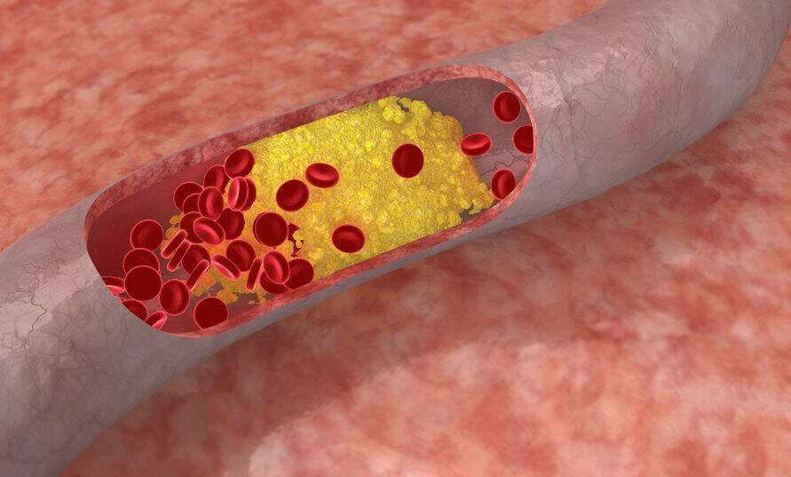 statin working inside blood vessel